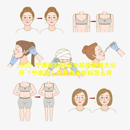 🌷 宁津皮肤科激光祛痘案例大公开「宁津县人民医院皮肤科怎么样」